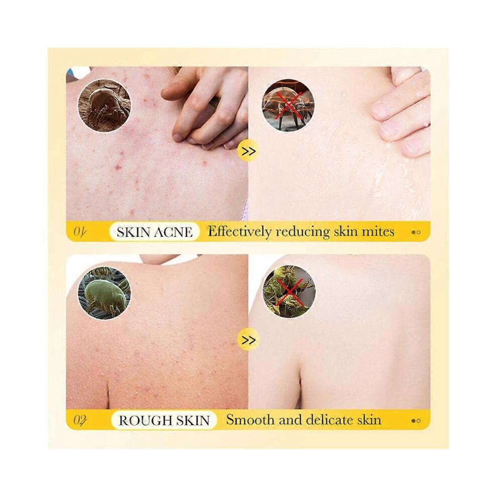 500ml Sterilization Moisturizing Super and Sulfur shower gel Scabies Mites Fat Body Wash Lotion Bath Skin Care Itching