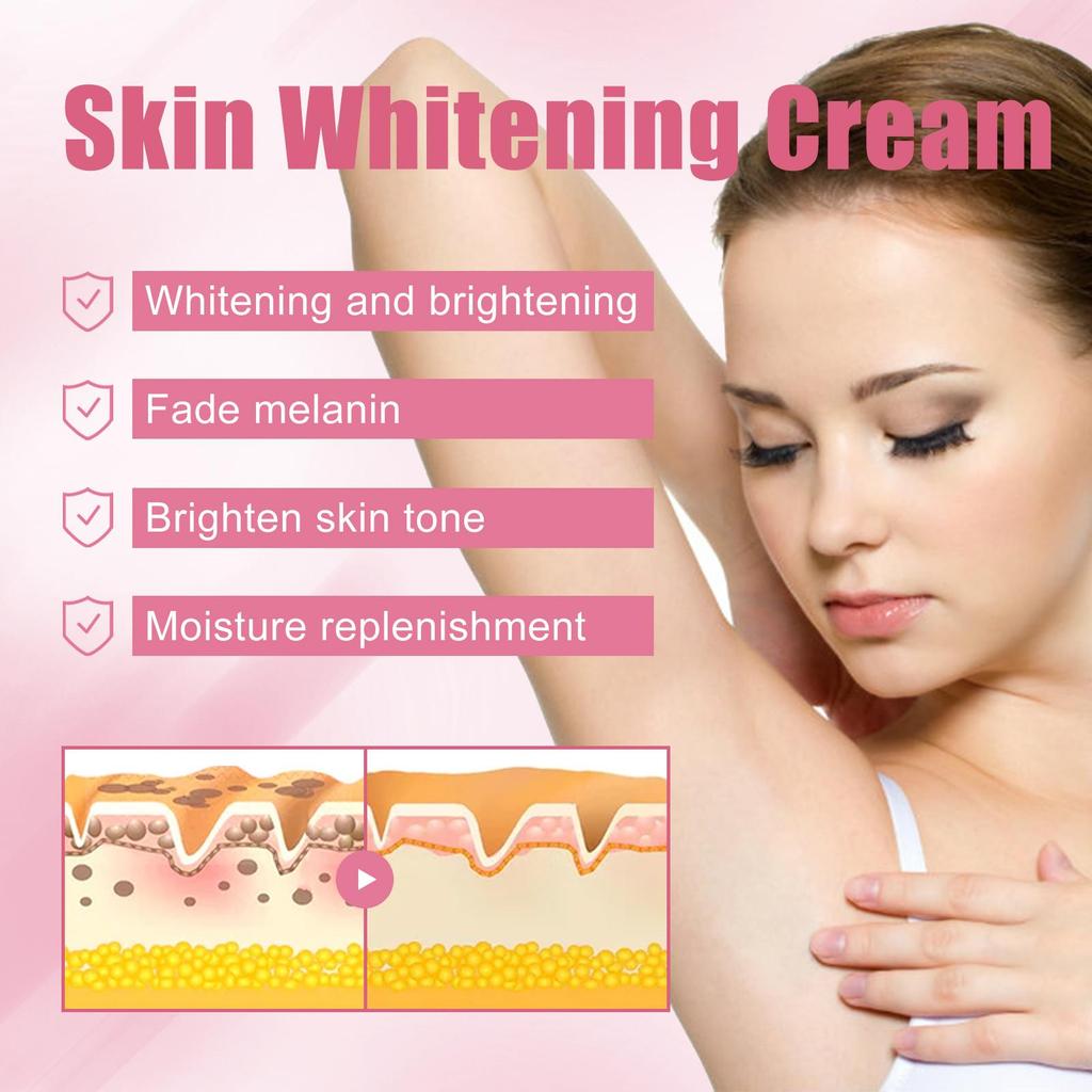 Body Bleaching Cream Brighten Dark Intimate Private Parts Knee Thigh Inner Joint Bikini Remove Melanin Pigmentation Nourish Skin