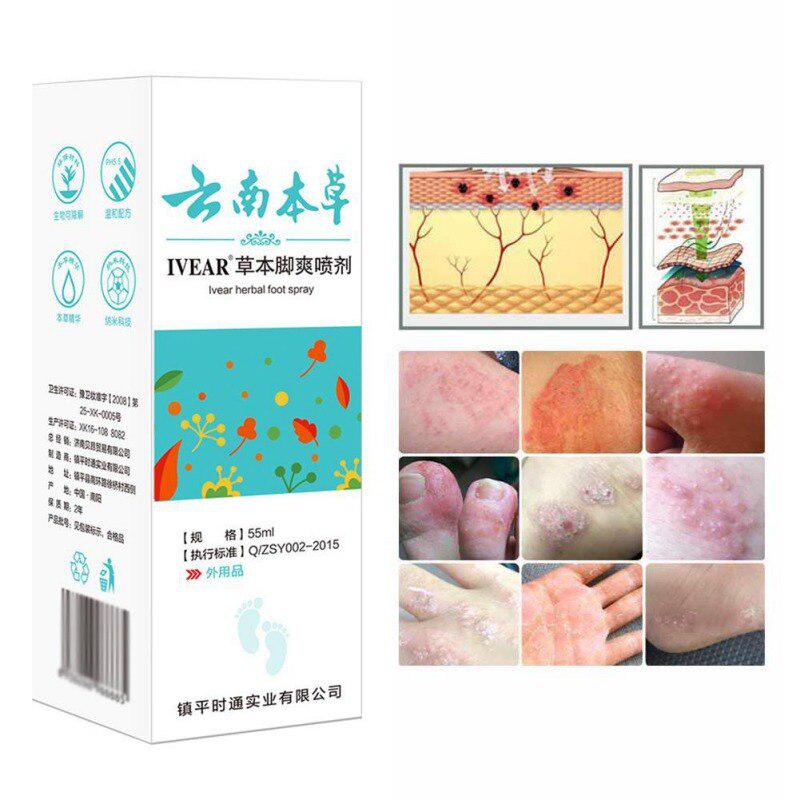 Antimykotikum-Spray für die Füße, pflanzliches Antimykotikum für Fußpilz, antibakterielles Deodorant-Pulver gegen Juckreiz, Schweiß und Geruch