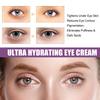 Retinol Eye Cream, Moisturizing And Firming Eye Cream, Improves Dullness And Reduces Fine Lines,1pc