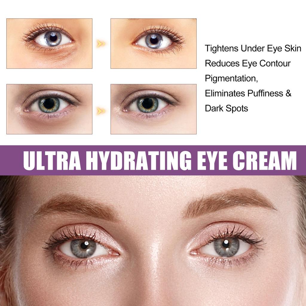 Retinol Eye Cream, Moisturizing And Firming Eye Cream, Improves Dullness And Reduces Fine Lines,1pc