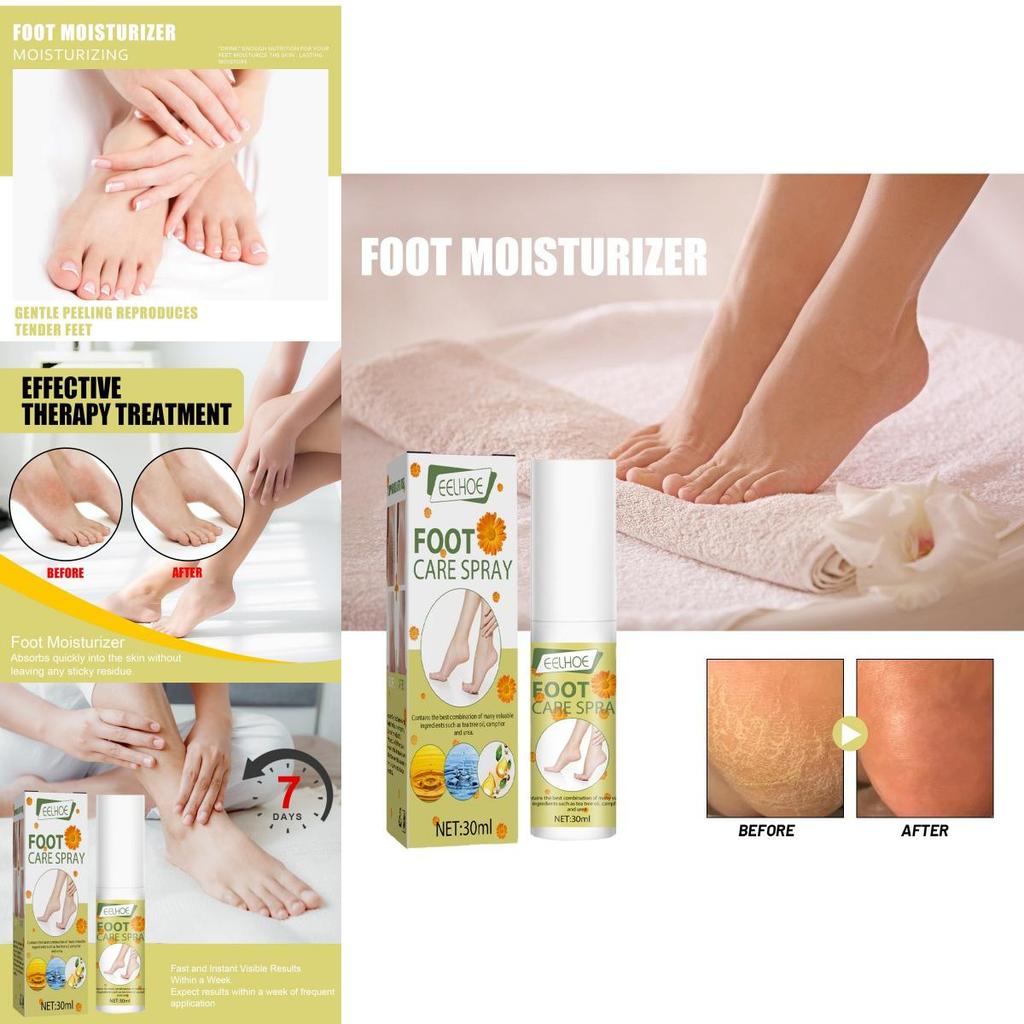 Eelhoe Moisturizing Foot Care Spray For Exfoliating Dead Skin And Softening Calluses 30ml