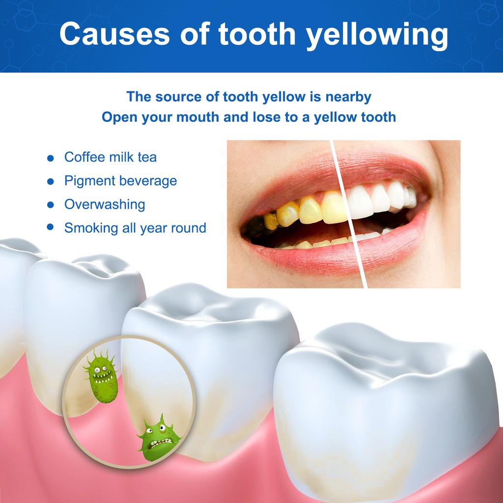 SP Probiotic Toothpaste Whiten Toothpaste Clean Mouth Stain Remove Fresh Breath Soft Foam Protect Gum Whiten Teeth Oral Care