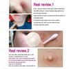 TOSOWOONG - SOS Repair Cica Clinic Acne Patch 66pcs
