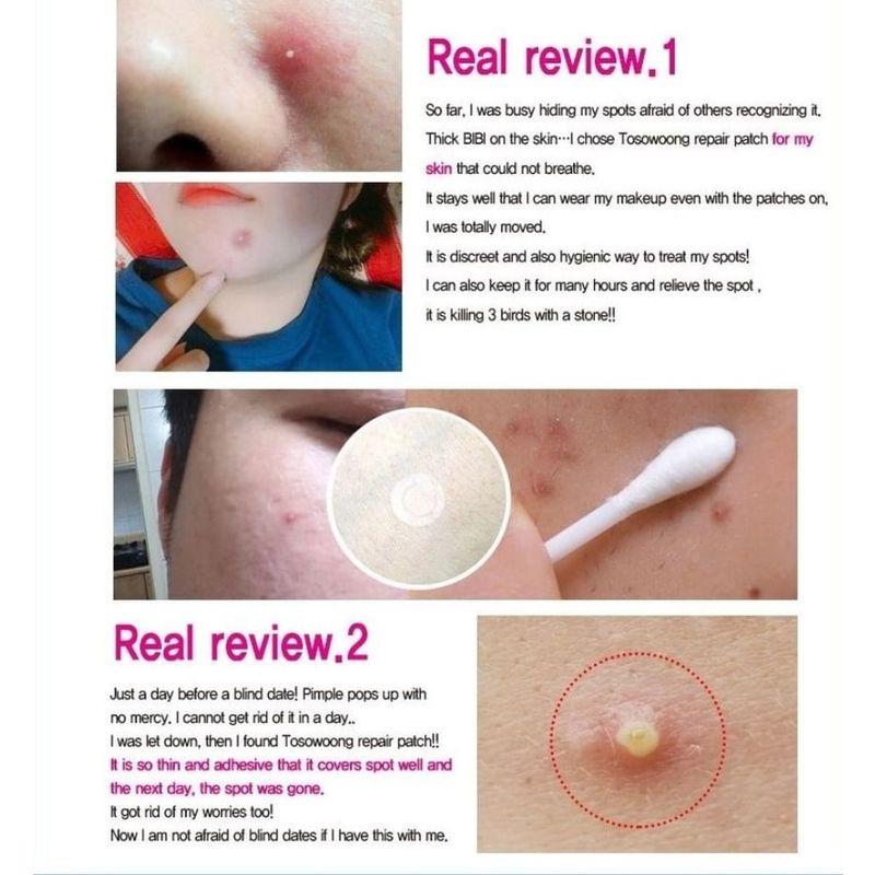 TOSOWOONG - SOS Repair Cica Clinic Acne Patch 66pcs