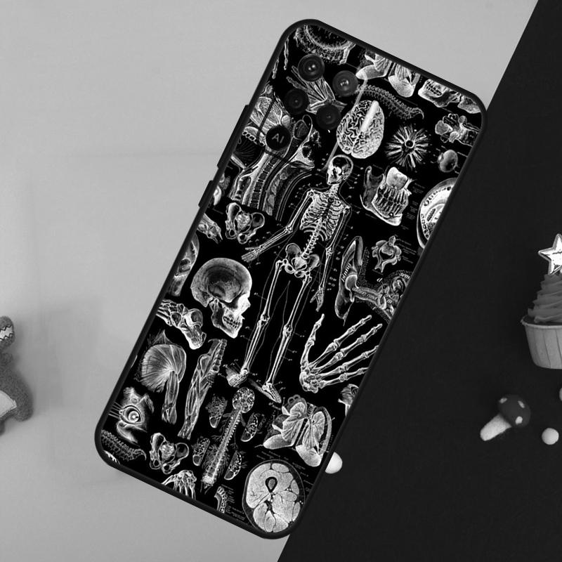 X-Ray Human Anatomy Case For Oppo A80 A60 A40 A54 A74 A94 A18 A38 A58 A78 A98 A96 A76 A16 A15 A17 A57 A5 A6 Pro