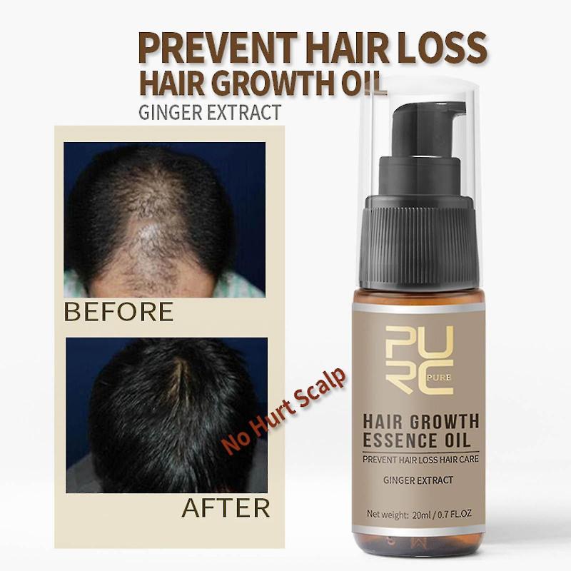 Hair Growth Essence Advanced Thinning Hair & Hair Loss Supplement 20ml Multicolor