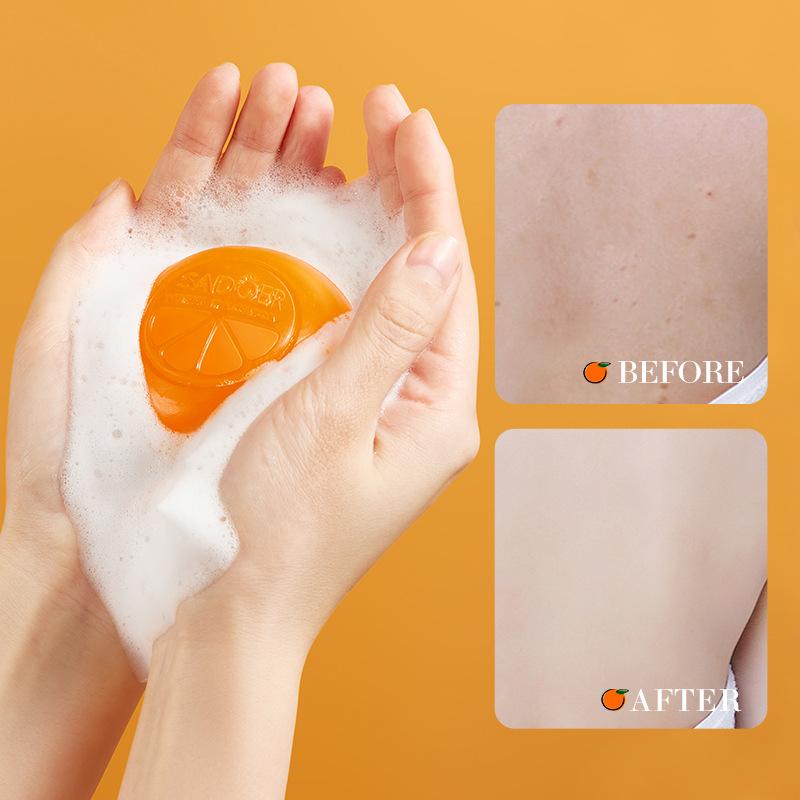 Vitamin C Seife SADOER Reinigungsbad Reinigungs Ätherisches Öl Handgemachte Seife