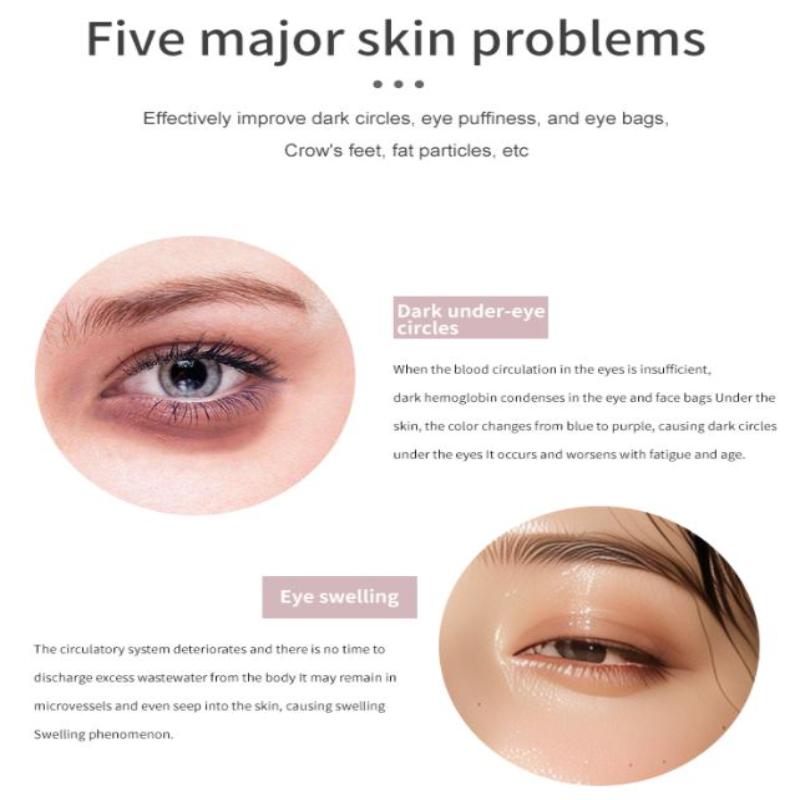 4 In 1 Electric Facial Massager Micro Vibration Eye Beauty Instrument For Relax Eye Dark Circles Eye Bags Puffiness Eye Massage