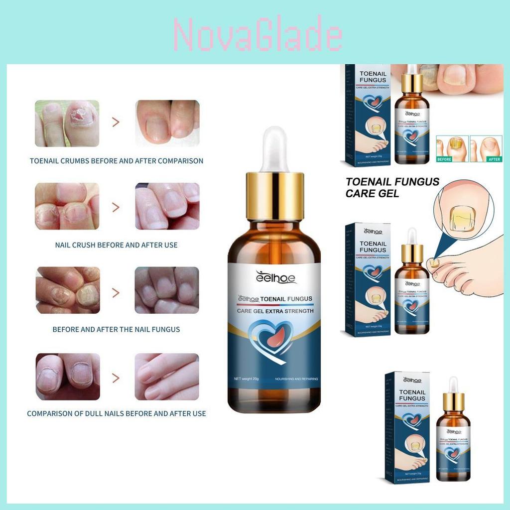 Eelhoe Toenail Care Gel For Yellow Thickened Nails With Fortifying And Restorative Formula