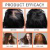 For Hair Growth,batan Oil,hair Growth Oil,hair Oil,Stimulates Hair Growth,  Moisturizes And Repairs Dryness,120g
