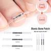 Bionic Nickel-Titanium Toenail Correction Patch