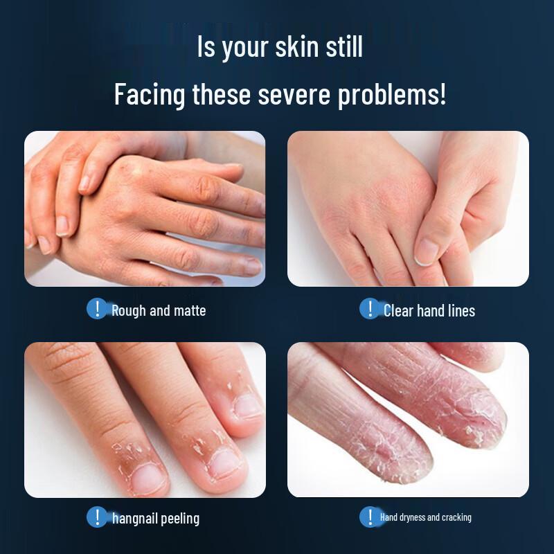 sakose Vaseline Hand Cream