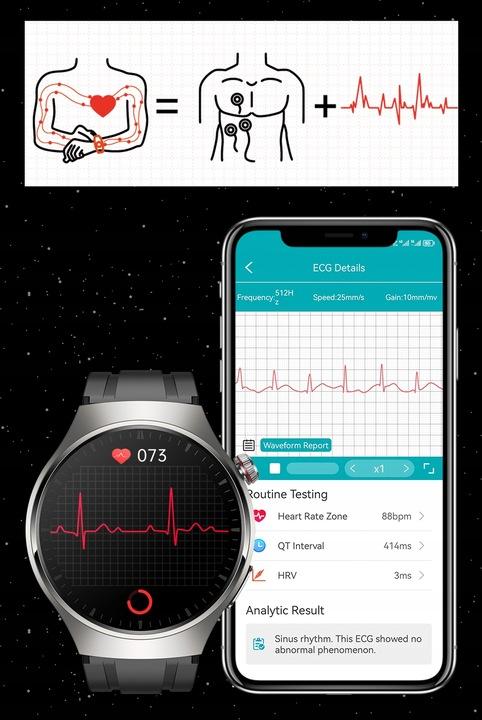 Zegarek Kardiowatch Z Pomiarem Glukozy Ekg Analiza Krwi Ciśnienie Amoled Pl