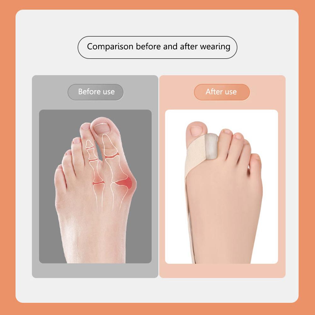 Unisex Toe Straightener Corrector Daily Wear Big Bone Toe Bunion Pull Strap Elastic Toe Separator Straightener for Foot Supplies