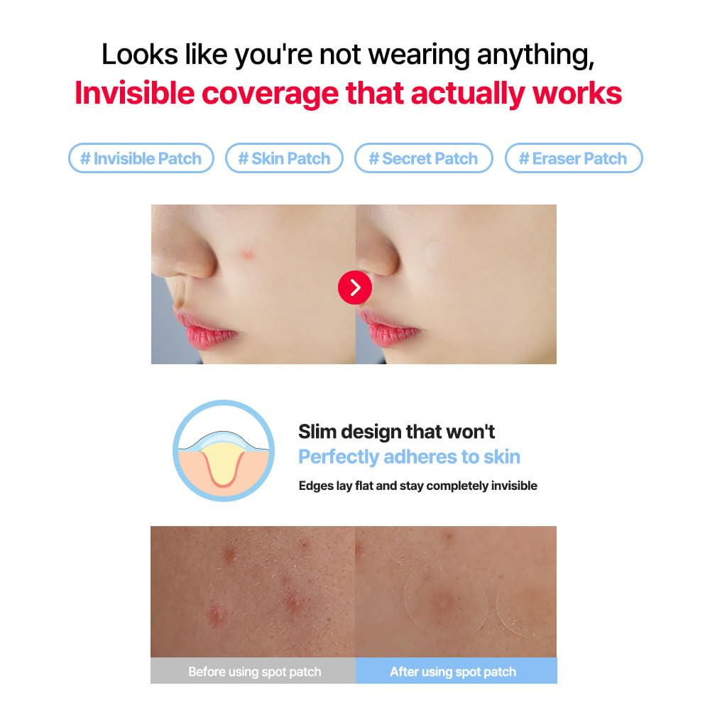 Zero Solution Spot Cover Patch Patches Per Discreet and Lasting [G9SKIN Official] (36 Pack) -