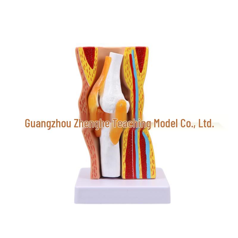 Removable Human Knee Joint Anatomy Model with Skin, Bones, Ligaments, and Meniscus for Medical Teaching