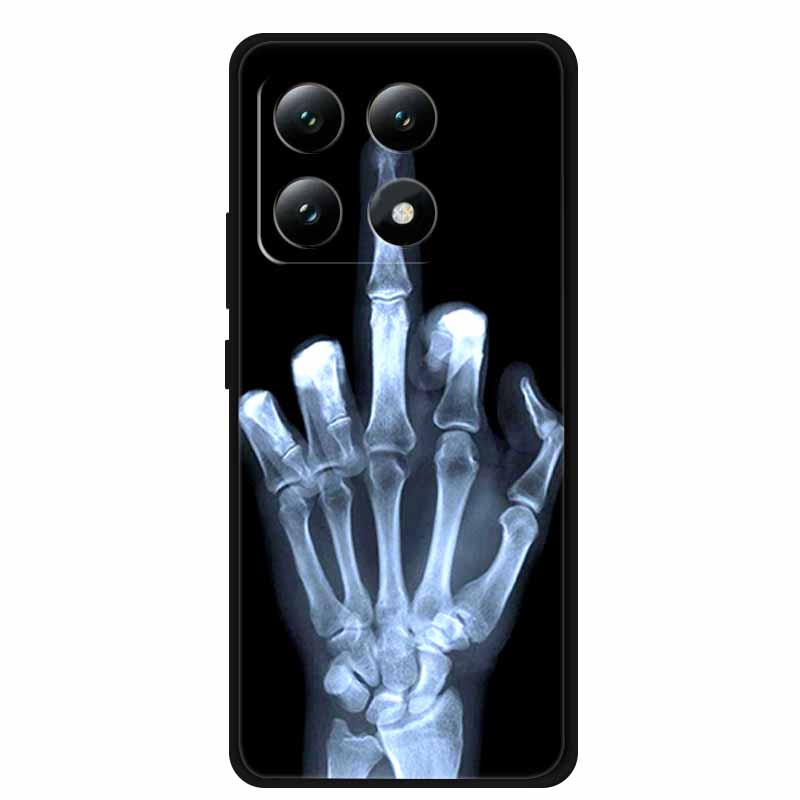 For Xiaomi 15T 5G Case Cool Animals Soft Silicone Phone Case for Xiaomi 15T Pro 5G Cover Ultra-Thin Dustproof Protective Funda