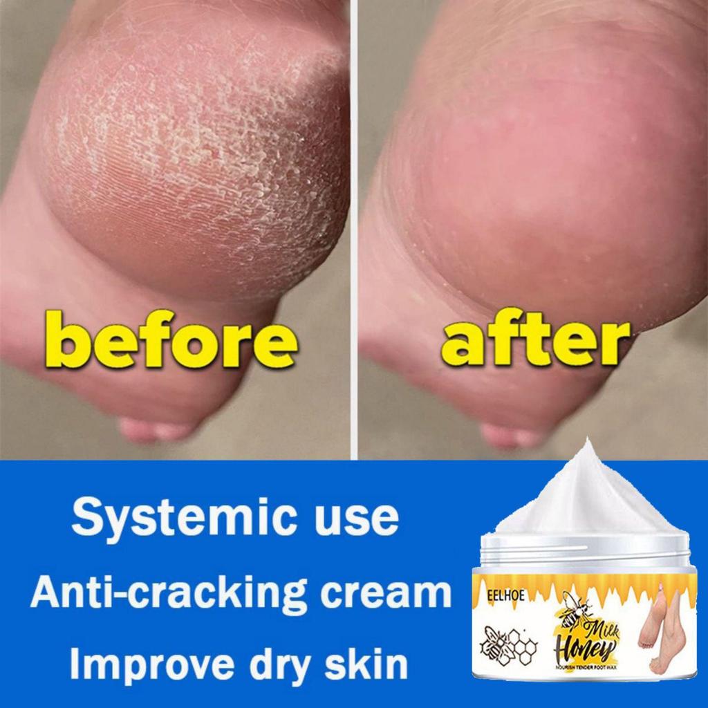 Sprukne hender og føtter reparerer krem, fukter, gir næring til huden og etterlater huden myk og delikat