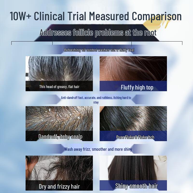 Moihanr Aminosäure Ölkontrolle Schuppen Volumen Shampoo