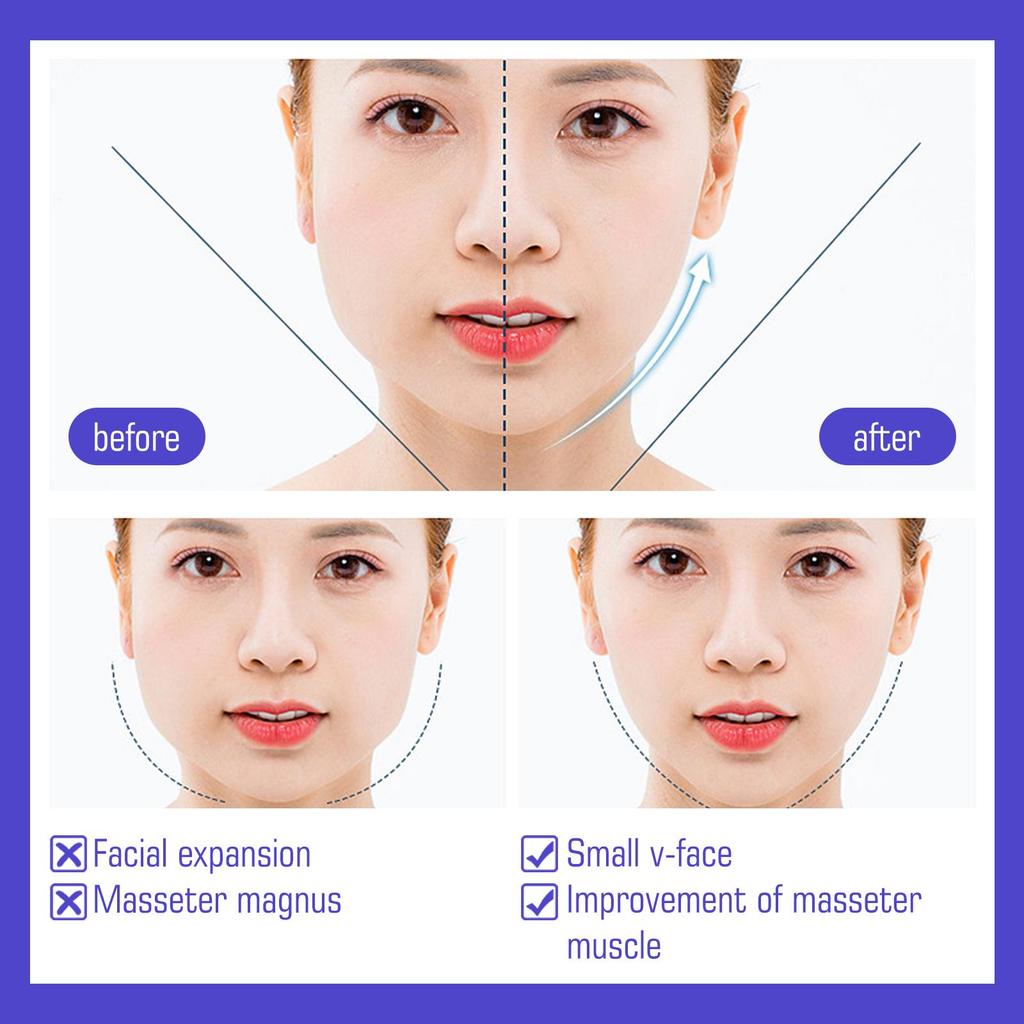 60 Stück Facelifting-Patch Hautstraffung Kinnverschlankung Muskellifting Schwellungsreduzierung Formender Patch