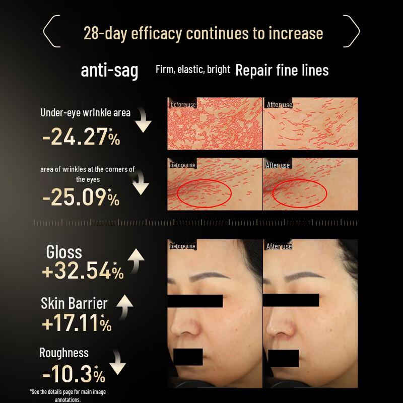 Mask Family 15% Bifida Ferment Lysate Anti-Aging Sheet Mask