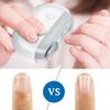 Intelligente Nagelknipser, elektrische Nagelknipser für Senioren, elektrische Nagelknipser, 3-in-1-automatische Nagelknipser