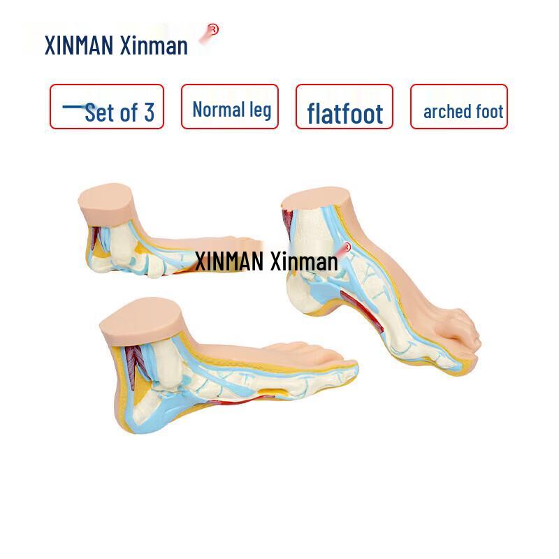 XINMAN Foot Arch Model
