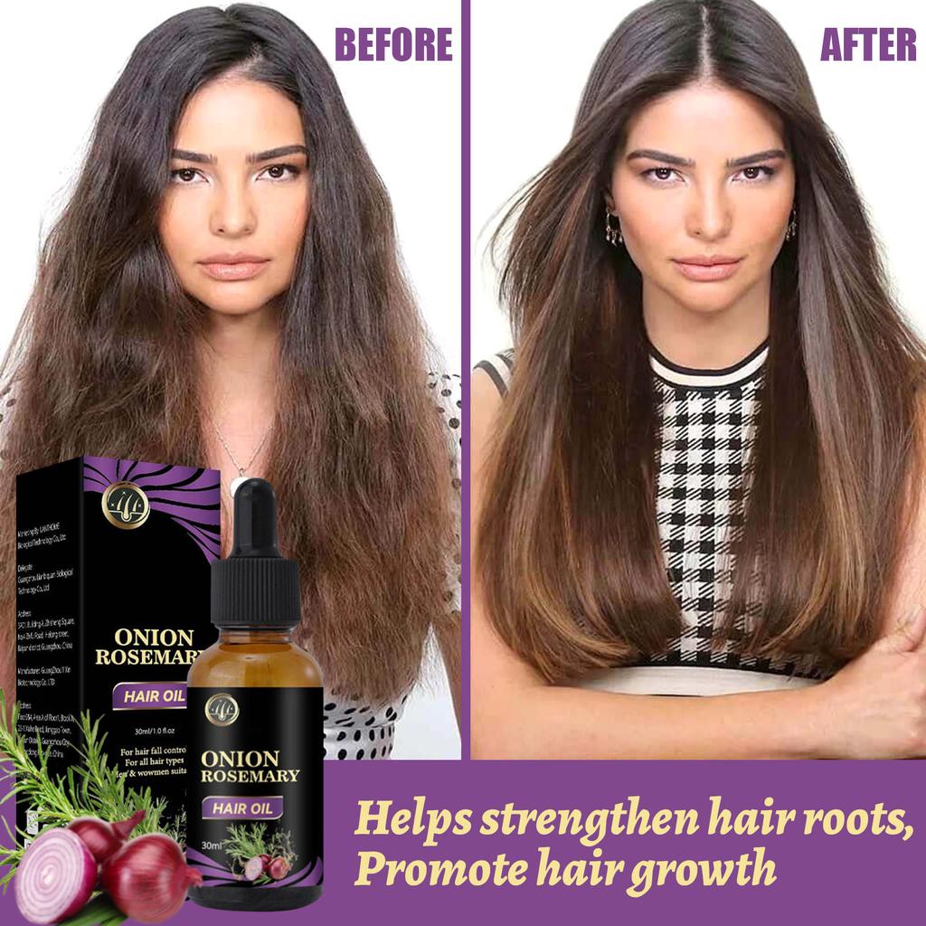 Hair Growth Spray Organic Hair Growth Oil Hair Growth  Black Seed Oil Anti-hair Loss 30ml