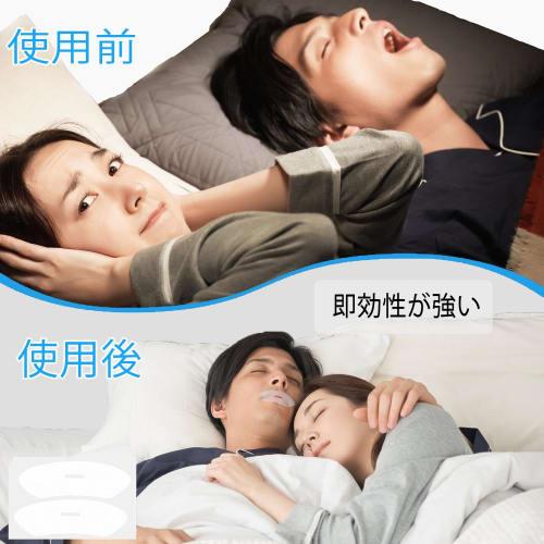 Anti-Snoring Tape, Mouth Closure Tape, Nose Breathing Tape, Prevents Throat Dryness, Reduces Snoring Noise, Promotes Nasal Breathing, Improves Bad Bre