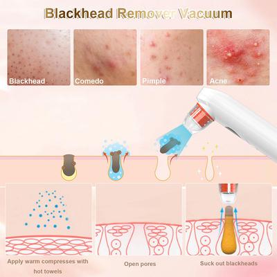 Visueller Mitesserentferner mit Kamera, Porenstaubsauger, Gesicht, schwarze Punkte, Pickel, Akne, Mitesserentfernung für Gesichtsreinigungswerkzeug