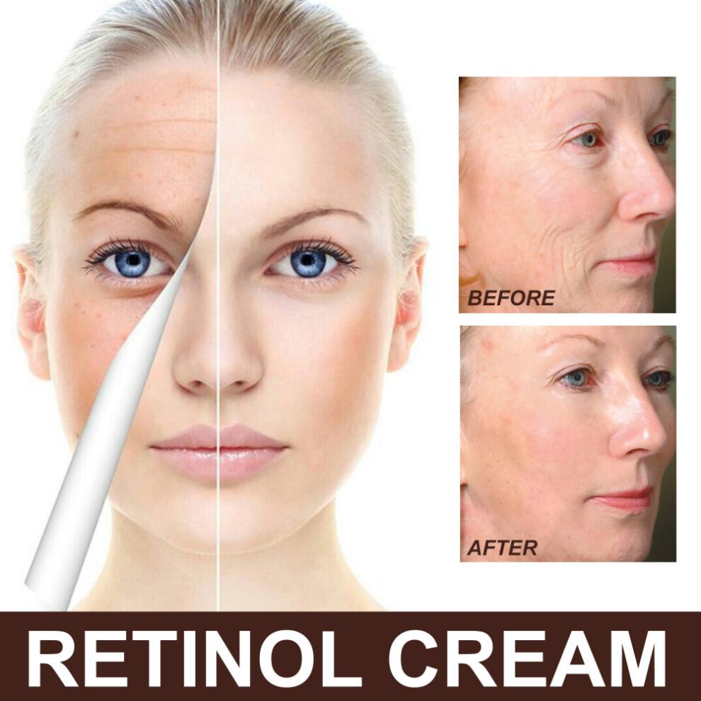 2X Retinolcreme mit Hyaluronsäure & Vitamin C - Anti-Aging, aufhellende & straffende Feuchtigkeitspflege für alle Hauttypen