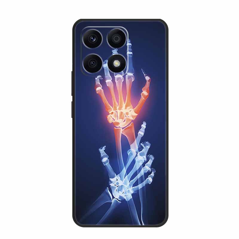 For Xiaomi 14T Pro Case 14TPro Phone Cover Fashion Photos Black Silicone Soft Phone Case For Xiaomi 14T Pro Back Cover Case Capa