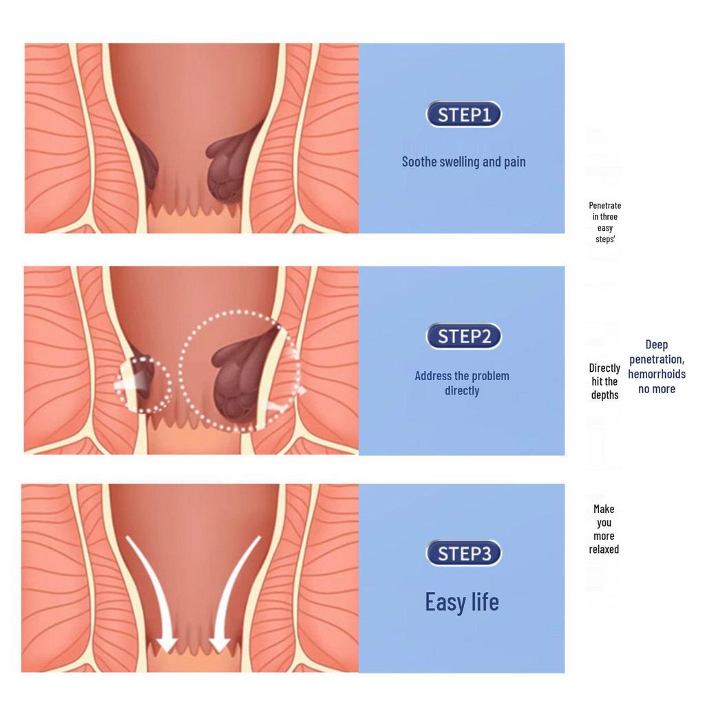 Atractylodes & Sophora Flavescens Herbal Hemorrhoid Cream - Internal/External Use Ointment