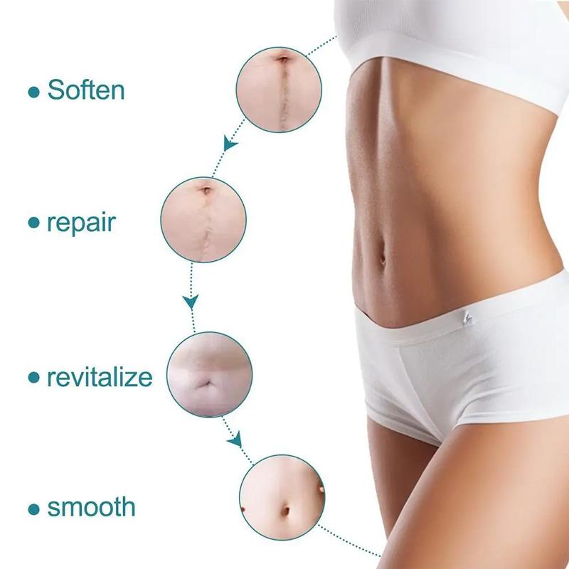 1 Roll Patch Skin Repair Self Adhesive 4X150CM Waterproof Scar Tape Non-slip Scar Sheets Skin Beauty Care Silicone Gel