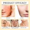 Bee-Venom Treatments Cream Wrinkles Remover Face Lotion Firming Lifting Anti Aging Moisturizing Whitening Repair Skin Care