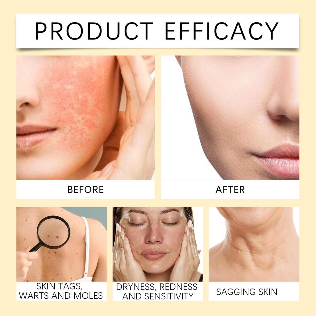 Bee-Venom Treatments Cream Wrinkles Remover Face Lotion Firming Lifting Anti Aging Moisturizing Whitening Repair Skin Care