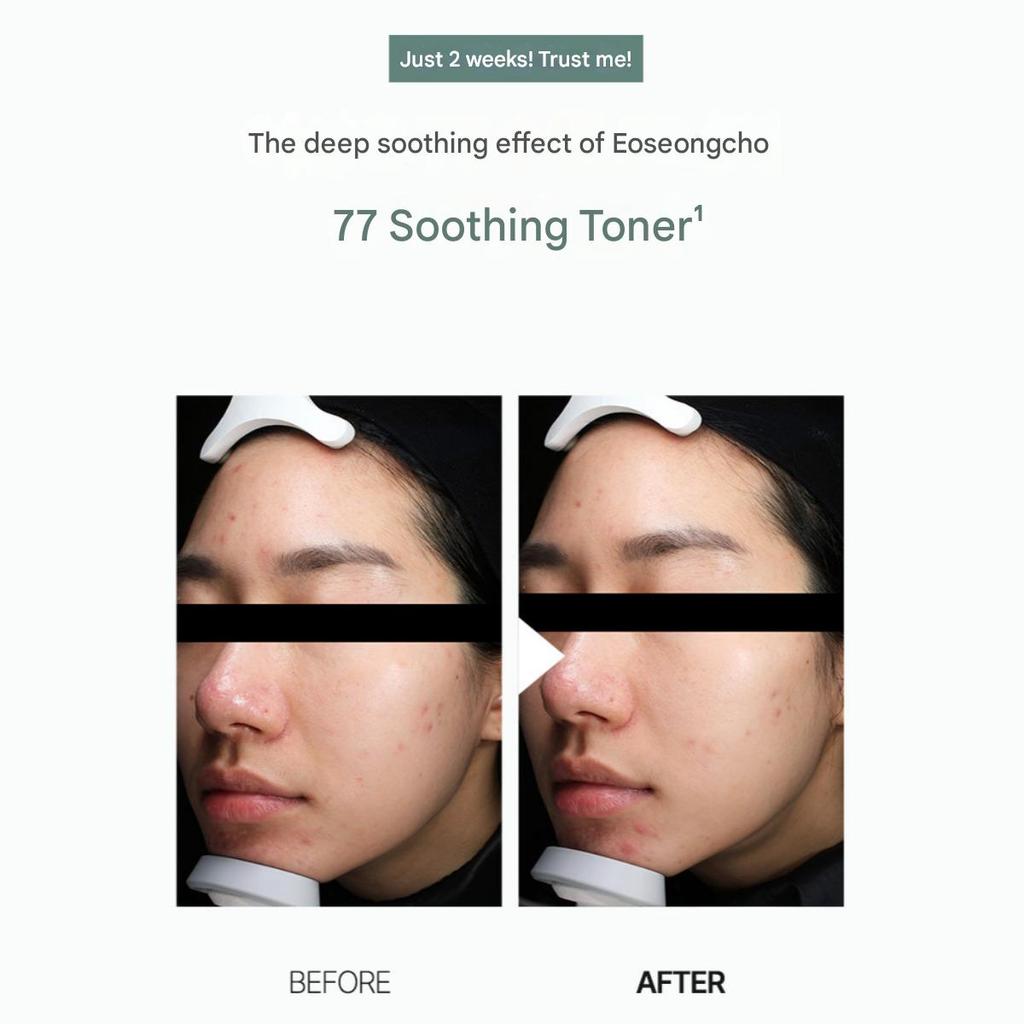 Anua Heartleaf 77% Beruhigendes Gesichtswasser