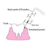 GDC Double End Probes Cp12 / Screening Probe #6 (Pcp12/11.5b)