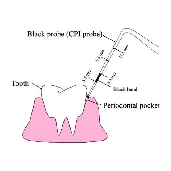GDC Double End Probes Cp12 / Screening Probe #6 (Pcp12/11.5b)