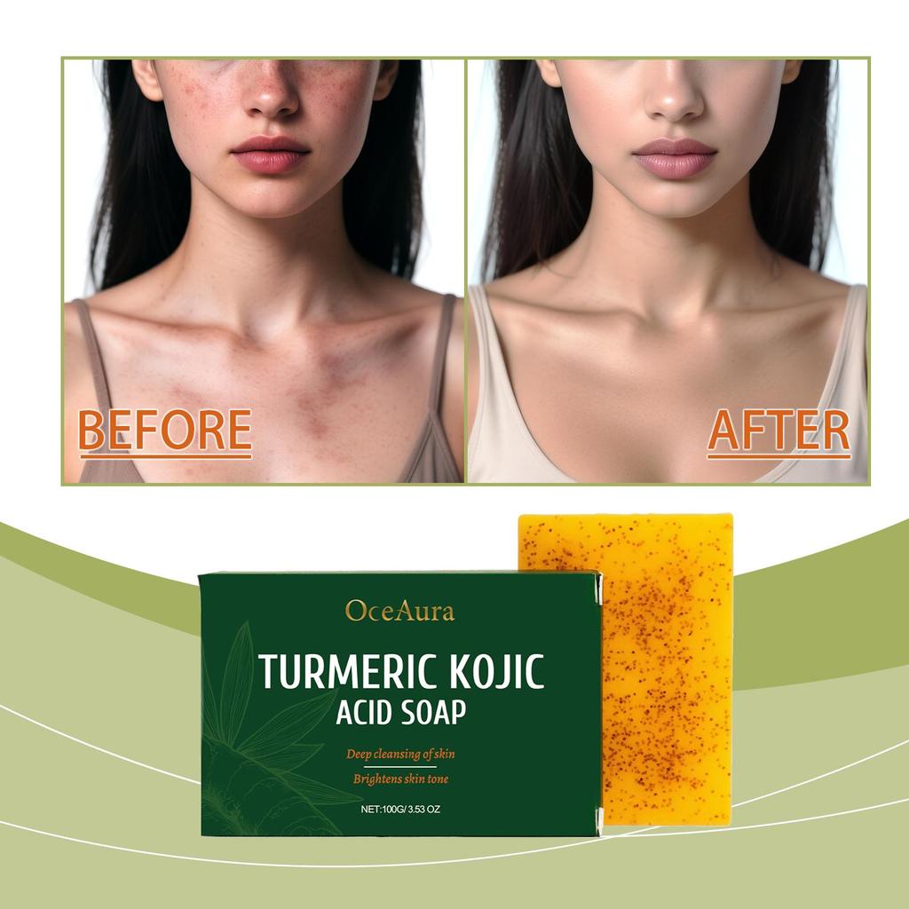 Rozjasňující mýdlo s kurkumou a kyselinou kojovou Odstraňovač tmavých skvrn Hloubkově čisticí Hydratační Sjednocuje tón pleti Ručně vyráběné mýdlo Péče o pleť