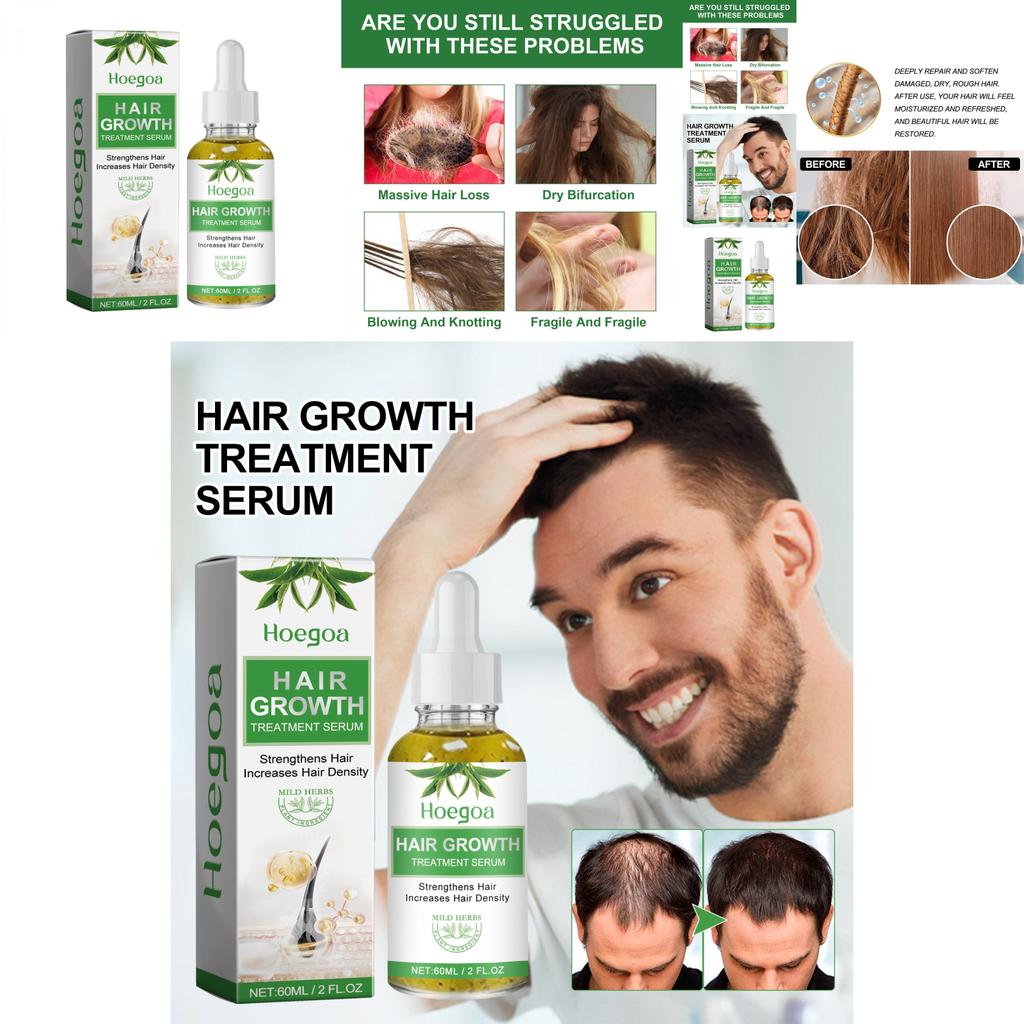 Hoegoa 60ml For Strong Resilient Hair With Natural Fragrance And Non-greasy Finish