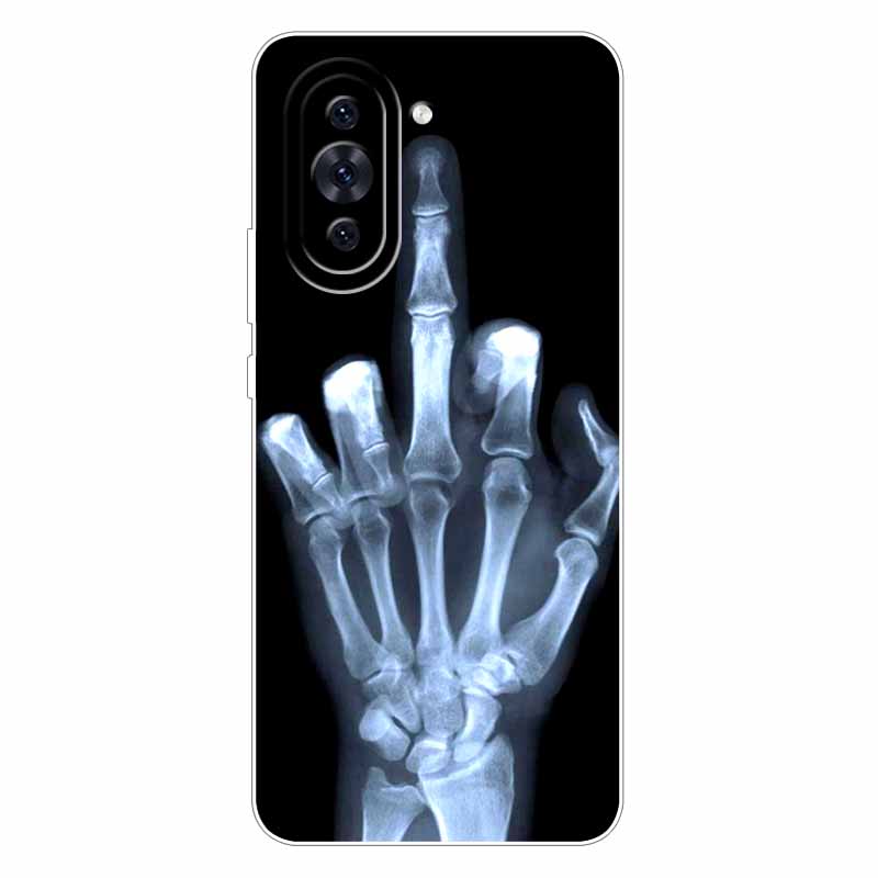 For Huawei Nova 10 Case Fashion Silicone Soft Cat Lion Back Cover for Huawei Nova 10 Case Protection Nova10 Cool Cartoon Shells
