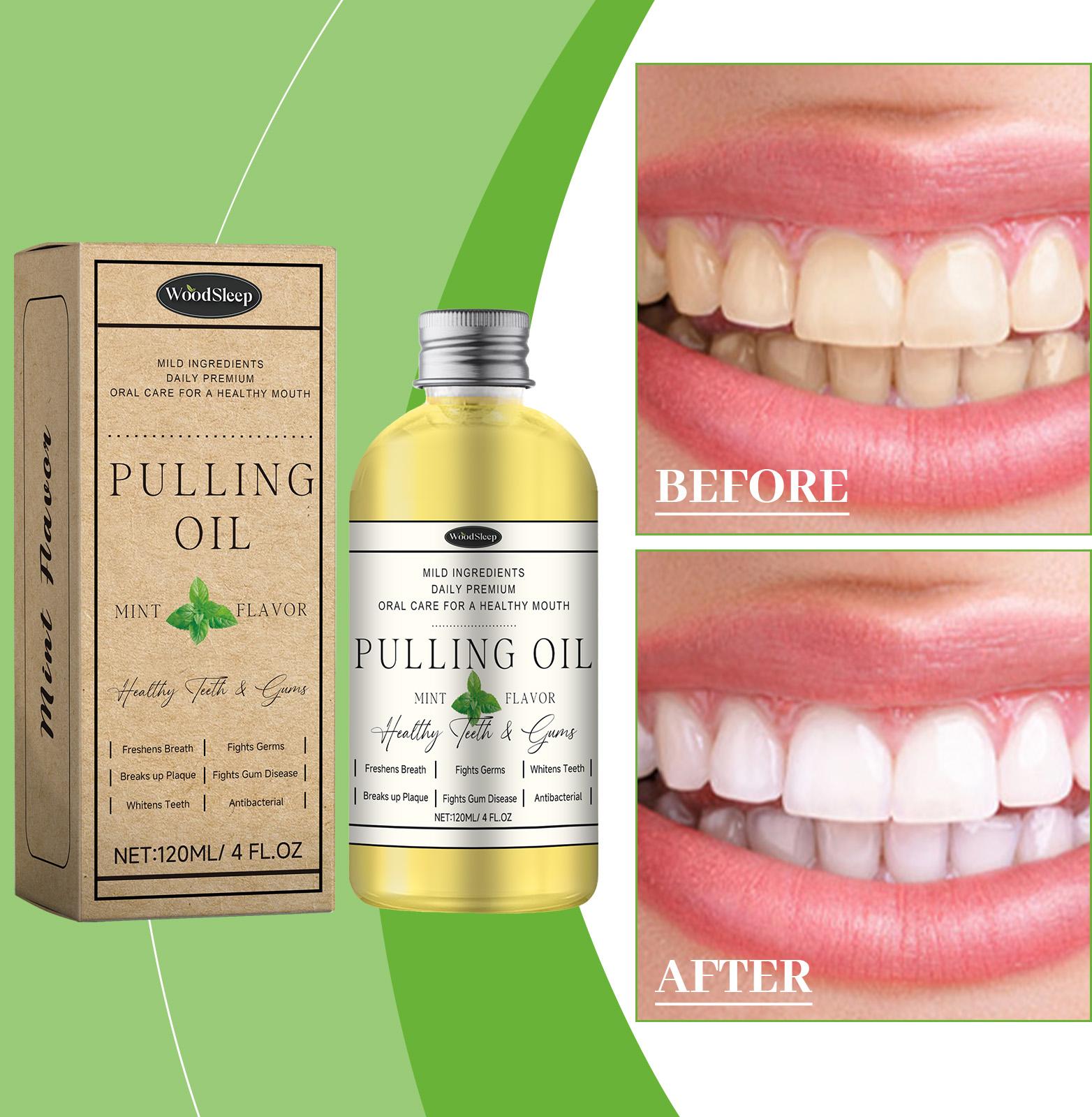 

Oral Coconut Mouthwash Oral Odor Cleaning Daily Care Teeth Fresh Cleanser