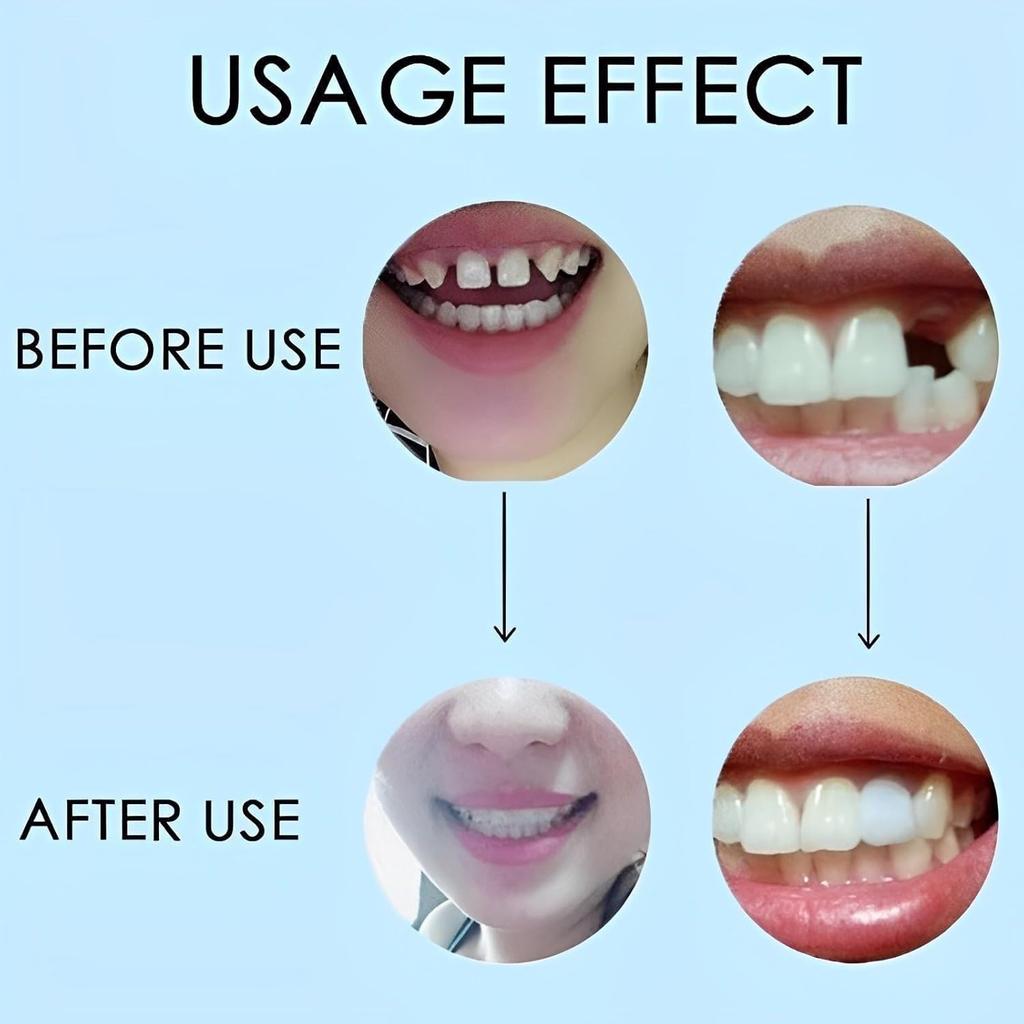 2 Paia, Naturale e Confortevole Ritrova Fiducia Sorriso, Regolabile Temporaneamente per Uomini e Donne(bianca)