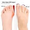 Silicone Hallux Valgus Corrector & Toe Separator with Three-Hole Design, Wearable in Shoes
