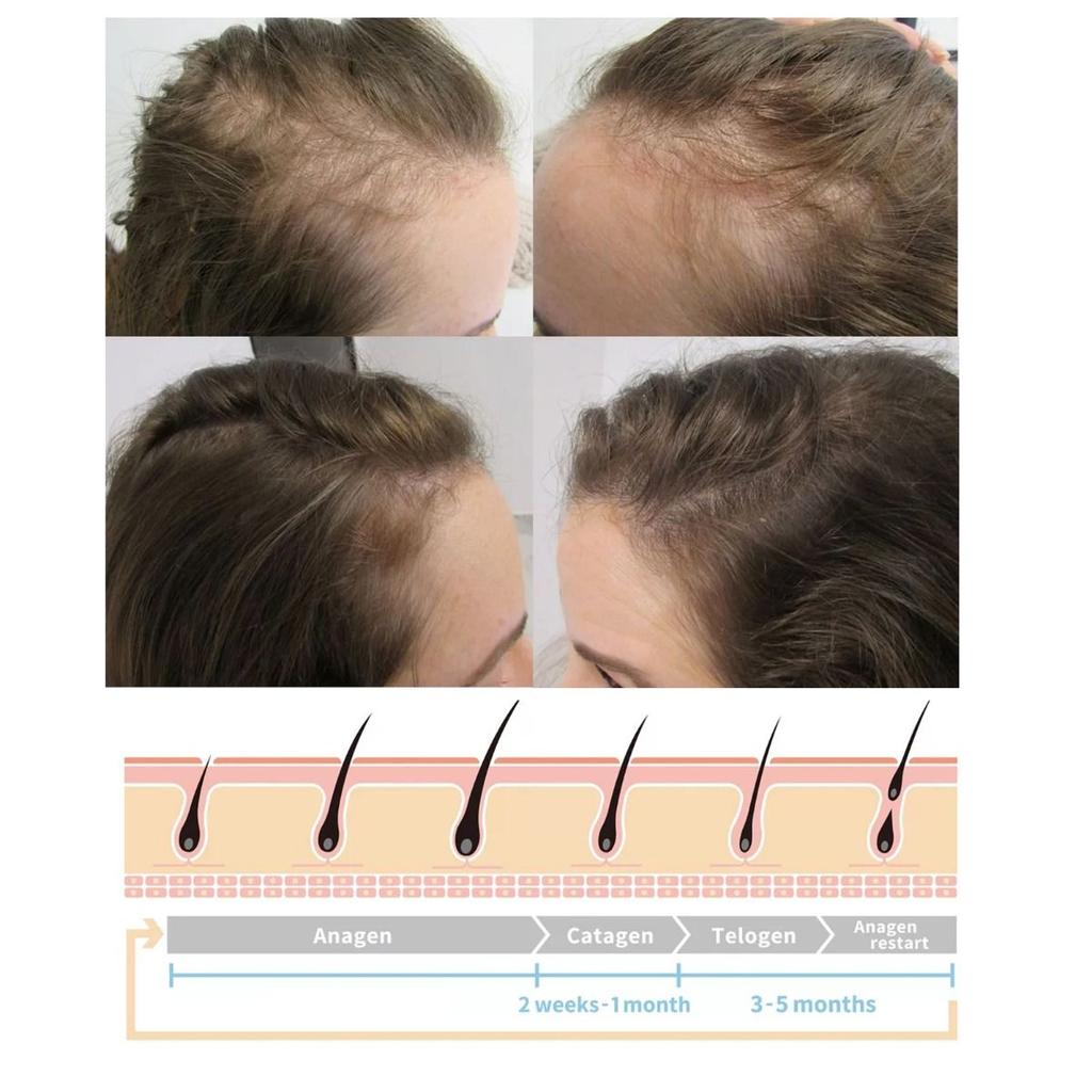 30ml Ginger Hair Growth Spray Scalp Nourishing Thick Hair Hair Care Nutrient Spray