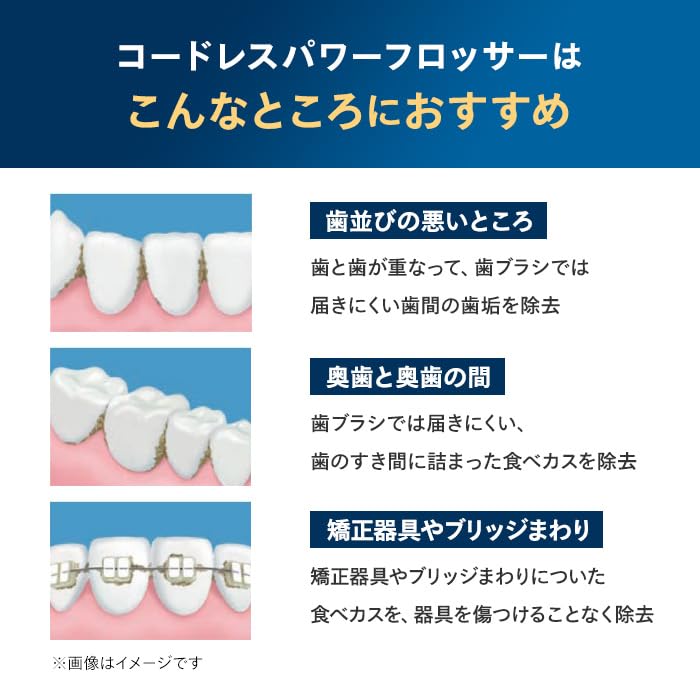 Philips Sonicare Cordless Power Flosser 3000 Oral Irrigator (X-Shaped Water Jet Washer) HX3826/23 Black [Amazon.co.jp Exclusive]