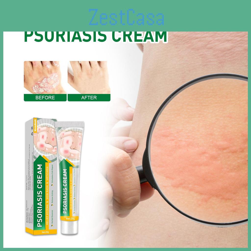 West Month Itch Relief Cream For Skin Soothing Effective For Mosquito Bites And Rashes