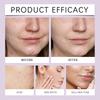 OUHOE Soothing Moisturizing Cream, Gentle and Hydrating, Evens Skin Tone, Reduces Dark Spots and Acne, Suitable for the Face, 30g